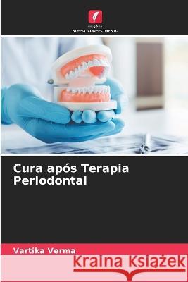 Cura apos Terapia Periodontal Vartika Verma   9786205728574