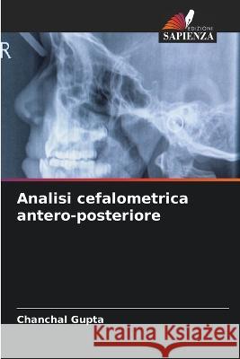 Analisi cefalometrica antero-posteriore Chanchal Gupta 9786205735053