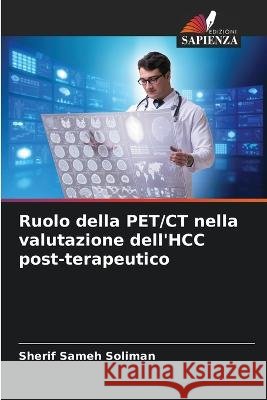 Ruolo della PET/CT nella valutazione dell\'HCC post-terapeutico Sherif Same 9786205743683