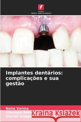 Implantes dent?rios: complica??es e sua gest?o Neha Verma Sharique Rehan Shefali Singla 9786205760239 Edicoes Nosso Conhecimento