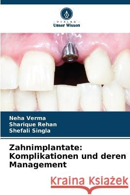 Zahnimplantate: Komplikationen und deren Management Neha Verma Sharique Rehan Shefali Singla 9786205760246 Verlag Unser Wissen