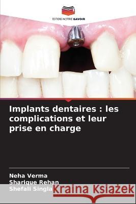 Implants dentaires: les complications et leur prise en charge Neha Verma Sharique Rehan Shefali Singla 9786205760260