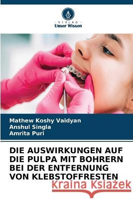 Die Auswirkungen Auf Die Pulpa Mit Bohrern Bei Der Entfernung Von Klebstoffresten Mathew Koshy Vaidyan Anshul Singla Amrita Puri 9786205787670 Verlag Unser Wissen