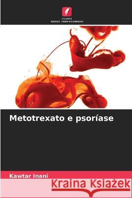 Metotrexato e psoriase Kawtar Inani   9786205793190
