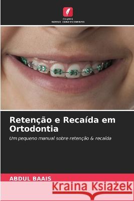 Retencao e Recaida em Ortodontia Abdul Baais   9786205807798 Edicoes Nosso Conhecimento