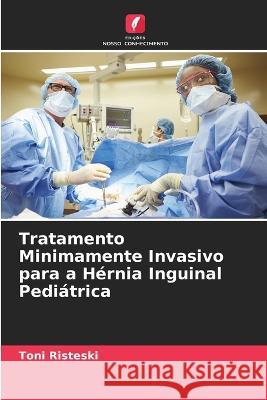 Tratamento Minimamente Invasivo para a Hernia Inguinal Pediatrica Toni Risteski   9786205815243 Edicoes Nosso Conhecimento