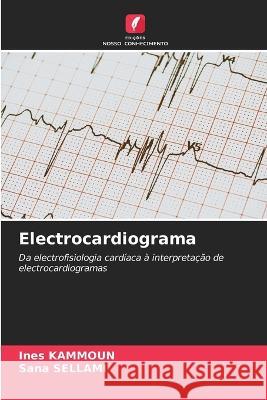 Electrocardiograma Ines Kammoun Sana Sellami 9786205822906 Edicoes Nosso Conhecimento