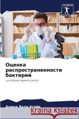 Оценка распространенно&#  Атайе 9786205823644 Sciencia Scripts