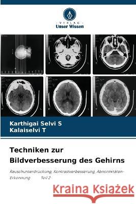 Techniken zur Bildverbesserung des Gehirns Karthigai Selvi S Kalaiselvi T  9786205841105 Verlag Unser Wissen