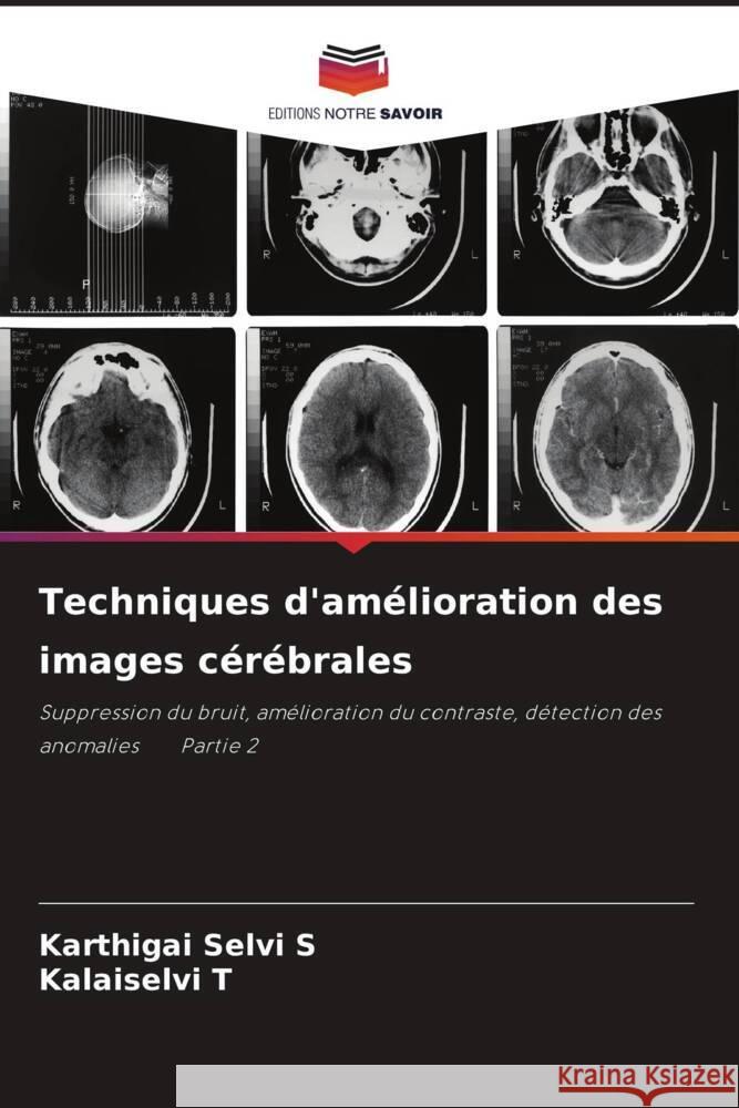 Techniques d'amelioration des images cerebrales Karthigai Selvi S Kalaiselvi T  9786205841334 Editions Notre Savoir