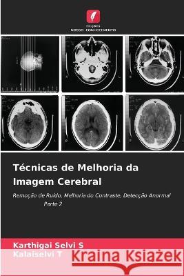 Tecnicas de Melhoria da Imagem Cerebral Karthigai Selvi S Kalaiselvi T  9786205841457 Edicoes Nosso Conhecimento