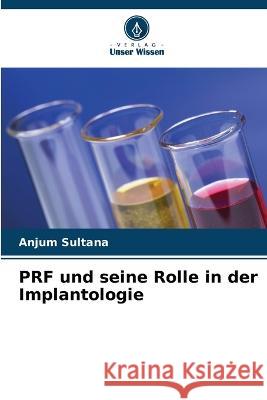 PRF und seine Rolle in der Implantologie Anjum Sultana 9786205842805