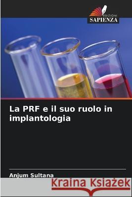 La PRF e il suo ruolo in implantologia Anjum Sultana 9786205842843