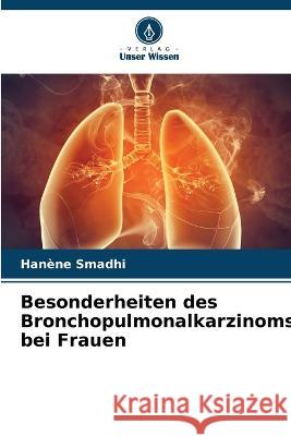 Besonderheiten des Bronchopulmonalkarzinoms bei Frauen Han?ne Smadhi 9786205844298 Verlag Unser Wissen