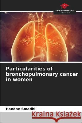 Particularities of bronchopulmonary cancer in women Han?ne Smadhi 9786205844304 Our Knowledge Publishing