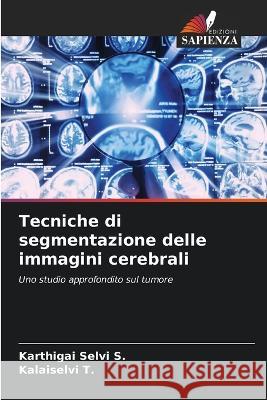 Tecniche di segmentazione delle immagini cerebrali Karthigai Selvi S Kalaiselvi T 9786205856666 Edizioni Sapienza