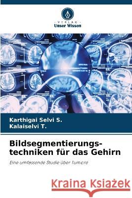 Bildsegmentierungs- techniken fur das Gehirn Karthigai Selvi S Kalaiselvi T  9786205858486