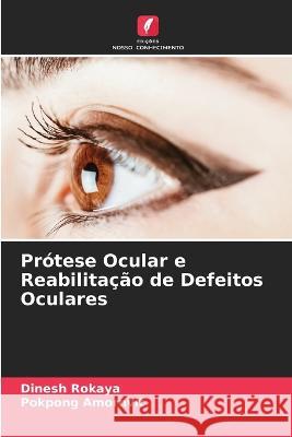 Pr?tese Ocular e Reabilita??o de Defeitos Oculares Dinesh Rokaya Pokpong Amornvit 9786205859421 Edicoes Nosso Conhecimento