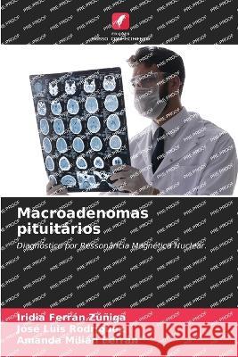 Macroadenomas pituitarios Iridia Ferran Zuniga Jose Luis Rodriguez Amanda Milian Ferran 9786205859902