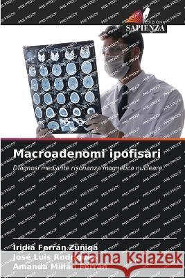 Macroadenomi ipofisari Iridia Ferran Zuniga Jose Luis Rodriguez Amanda Milian Ferran 9786205859971