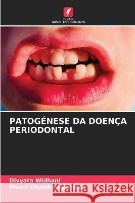 Patogenese Da Doenca Periodontal Divyata Widhani Manvi Chandra Agarwal  9786205871423