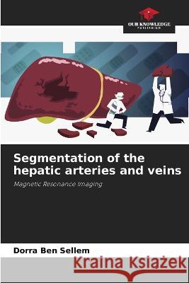 Segmentation of the hepatic arteries and veins Dorra Be 9786205875988 Our Knowledge Publishing