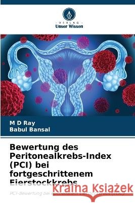 Bewertung des Peritonealkrebs-Index (PCI) bei fortgeschrittenem Eierstockkrebs Ray, M D Babul Bansal  9786205885222 Verlag Unser Wissen