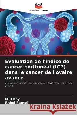Evaluation de l'indice de cancer peritoneal (ICP) dans le cancer de l'ovaire avance Ray, M D Babul Bansal  9786205885246 Editions Notre Savoir