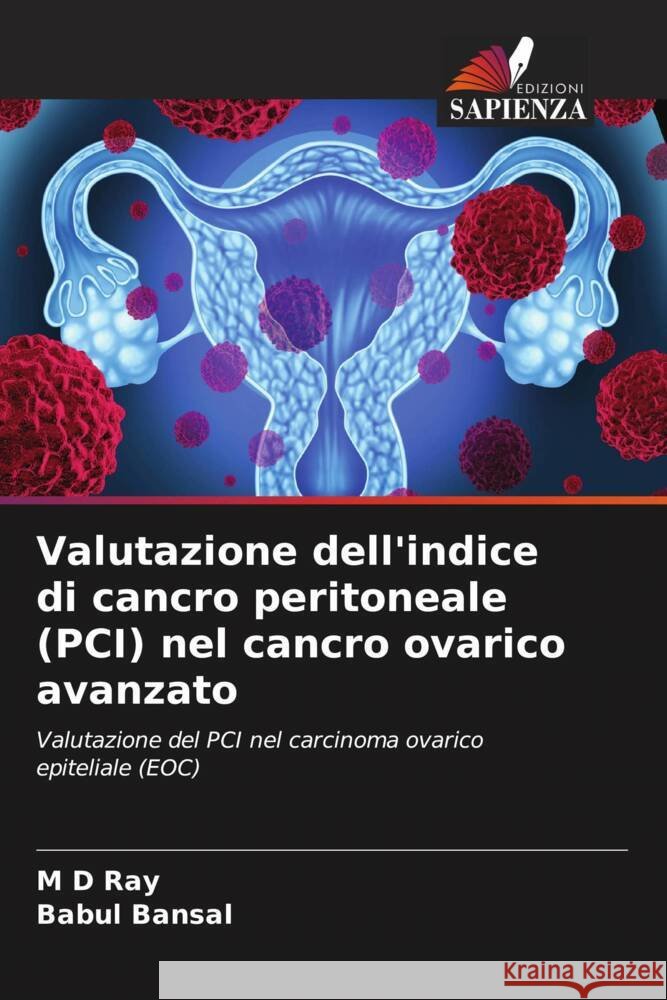Valutazione dell'indice di cancro peritoneale (PCI) nel cancro ovarico avanzato Ray, M D Babul Bansal  9786205885253 Edizioni Sapienza