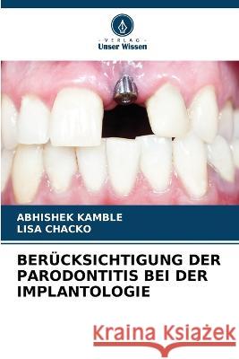 Berucksichtigung Der Parodontitis Bei Der Implantologie Abhishek Kamble Lisa Chacko  9786205888186 Verlag Unser Wissen