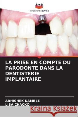 La Prise En Compte Du Parodonte Dans La Dentisterie Implantaire Abhishek Kamble Lisa Chacko  9786205888193 Editions Notre Savoir