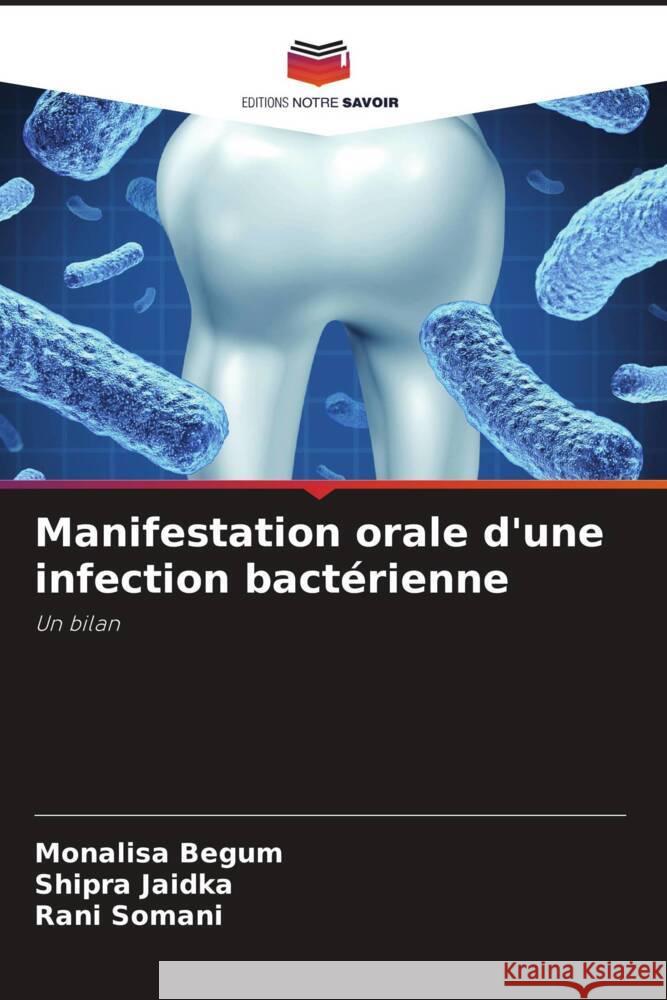 Manifestation orale d'une infection bacterienne Monalisa Begum Shipra Jaidka Rani Somani 9786205888612 Editions Notre Savoir