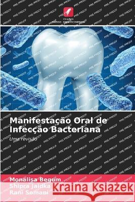 Manifestacao Oral de Infeccao Bacteriana Monalisa Begum Shipra Jaidka Rani Somani 9786205888636 Edicoes Nosso Conhecimento