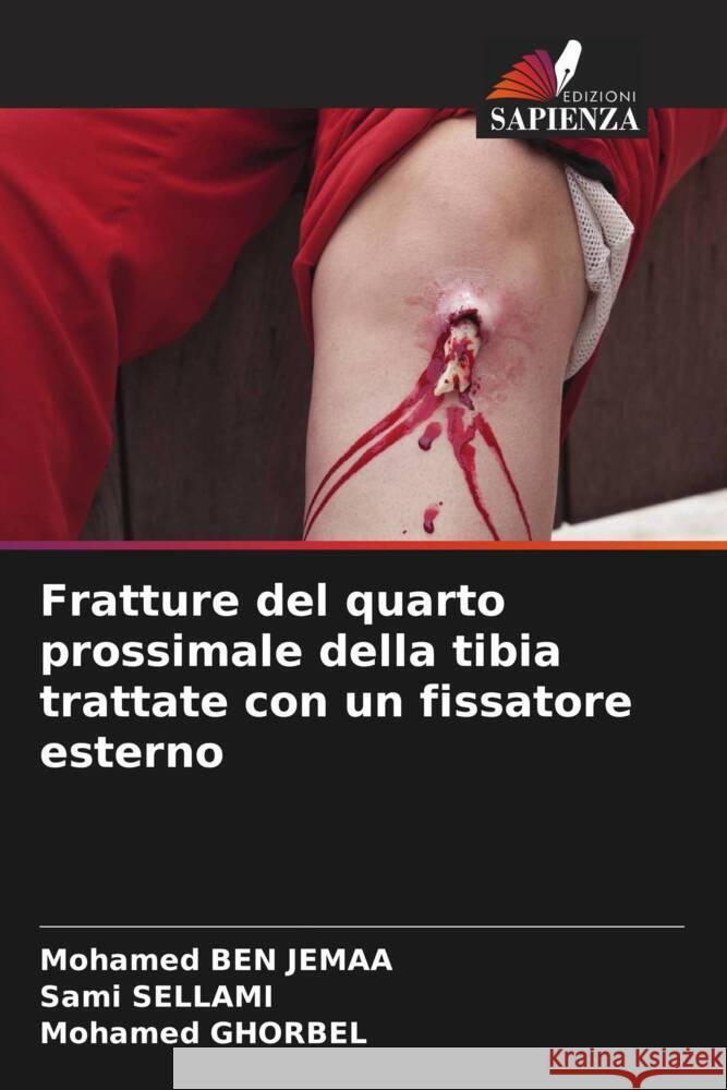 Fratture del quarto prossimale della tibia trattate con un fissatore esterno Mohamed Ben Jemaa Sami Sellami Mohamed Ghorbel 9786205899465