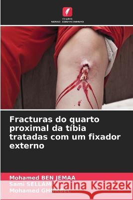 Fracturas do quarto proximal da tibia tratadas com um fixador externo Mohamed Ben Jemaa Sami Sellami Mohamed Ghorbel 9786205899496 Edicoes Nosso Conhecimento