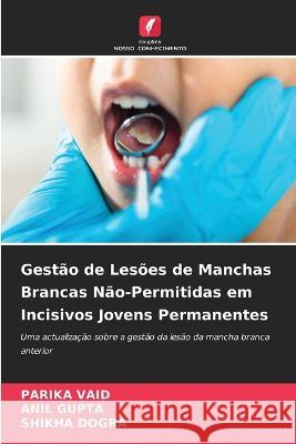 Gestao de Lesoes de Manchas Brancas Nao-Permitidas em Incisivos Jovens Permanentes Parika Vaid Anil Gupta Shikha Dogra 9786205909485 Edicoes Nosso Conhecimento