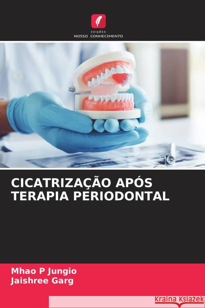 Cicatrizacao Apos Terapia Periodontal Mhao P Jungio Jaishree Garg  9786205913390