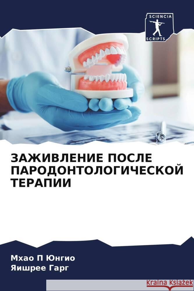 ZAZhIVLENIE POSLE PARODONTOLOGIChESKOJ TERAPII Jungio, Mhao P, Garg, Yaishree 9786205913406