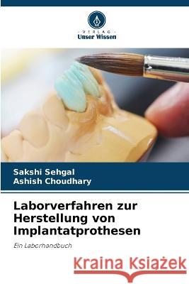 Laborverfahren zur Herstellung von Implantatprothesen Sakshi Sehgal Ashish Choudhary  9786205932377