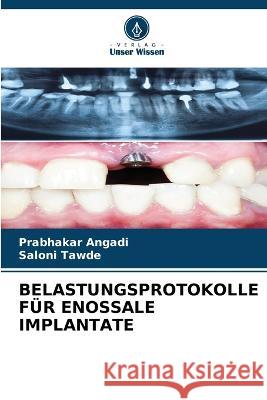 Belastungsprotokolle Fur Enossale Implantate Prabhakar Angadi Saloni Tawde  9786205934876 Verlag Unser Wissen
