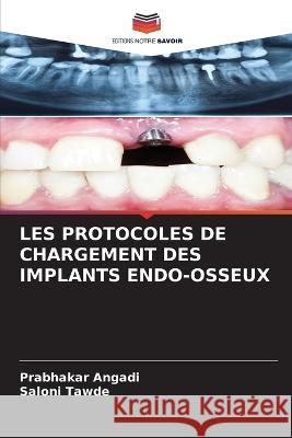 Les Protocoles de Chargement Des Implants Endo-Osseux Prabhakar Angadi Saloni Tawde  9786205934906 Editions Notre Savoir