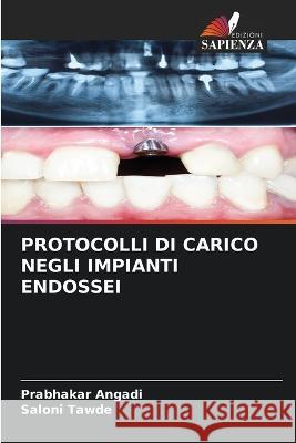 Protocolli Di Carico Negli Impianti Endossei Prabhakar Angadi Saloni Tawde  9786205934913 Edizioni Sapienza