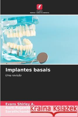 Implantes basais Evans Shirley a Aarti Rajambigai Sarathchandra Govindraj 9786205944042 Edicoes Nosso Conhecimento