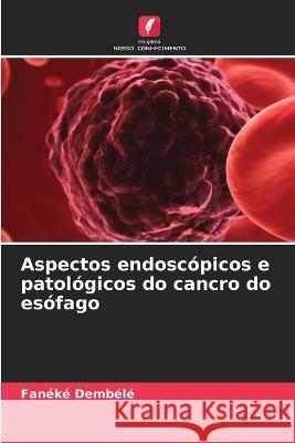 Aspectos endoscopicos e patologicos do cancro do esofago Faneke Dembele   9786205945223 Edicoes Nosso Conhecimento