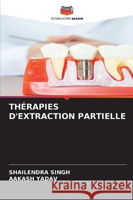 Therapies d'Extraction Partielle Shailendra Singh Aakash Yadav  9786205954263 Editions Notre Savoir