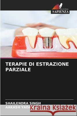 Terapie Di Estrazione Parziale Shailendra Singh Aakash Yadav  9786205954270 Edizioni Sapienza