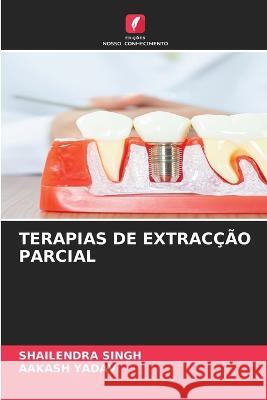 Terapias de Extraccao Parcial Shailendra Singh Aakash Yadav  9786205954287 Edicoes Nosso Conhecimento