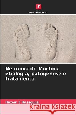 Neuroma de Morton: etiologia, patogenese e tratamento Hazem Z Hassouna   9786205960349 Edicoes Nosso Conhecimento