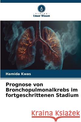 Prognose von Bronchopulmonalkrebs im fortgeschrittenen Stadium Hamida Kwas   9786205964057