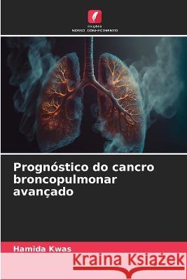 Prognostico do cancro broncopulmonar avancado Hamida Kwas   9786205964088